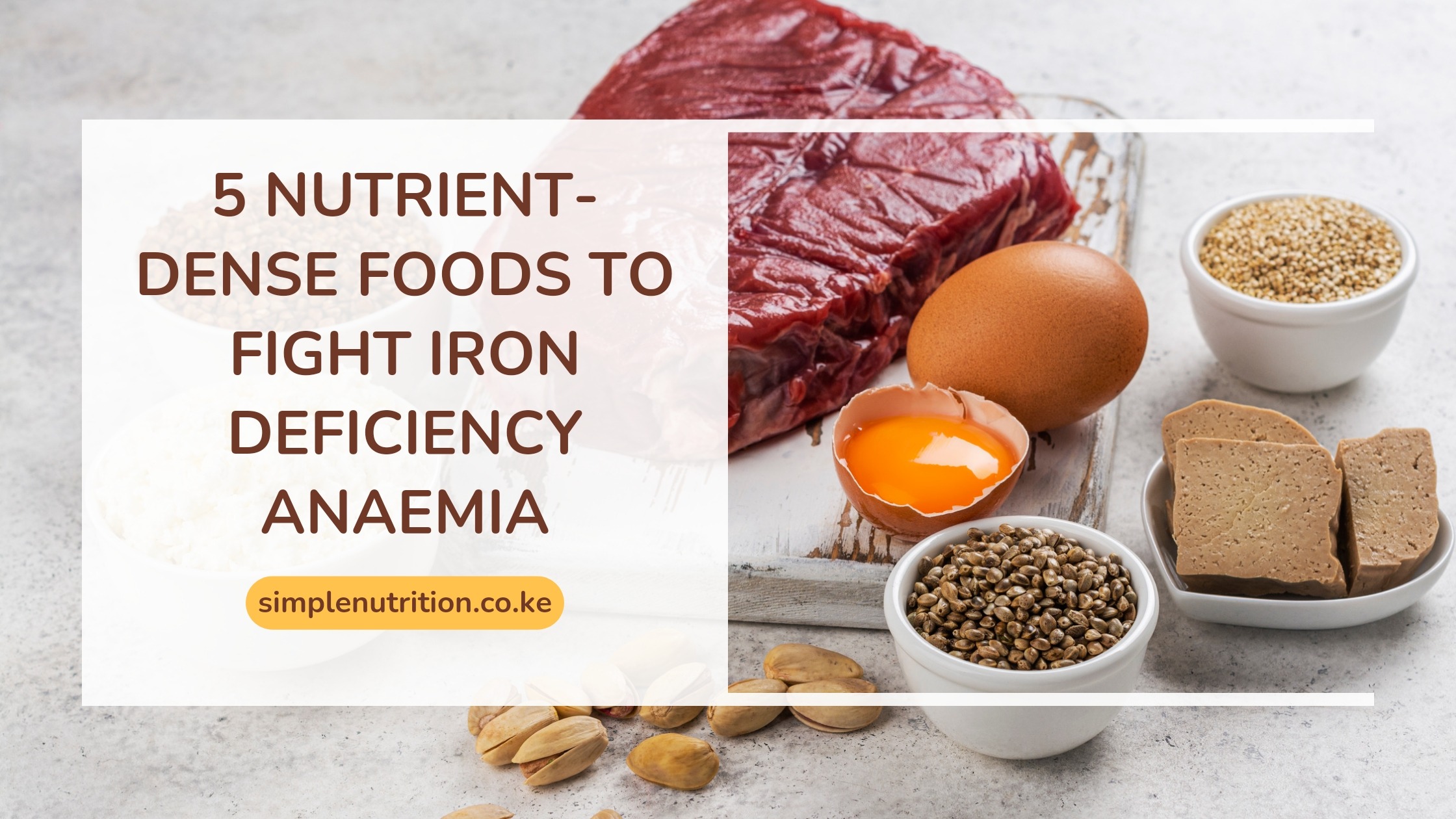 Here are 5 nutrient-dense foods that can help manage iron deficiency anemia.