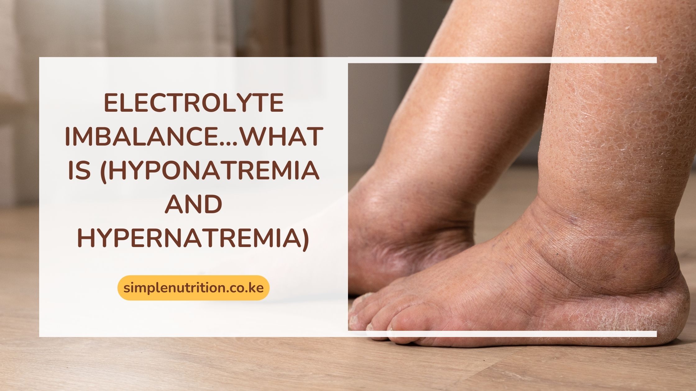 Electrolyte imbalance…What is (Hyponatremia and hypernatremia)