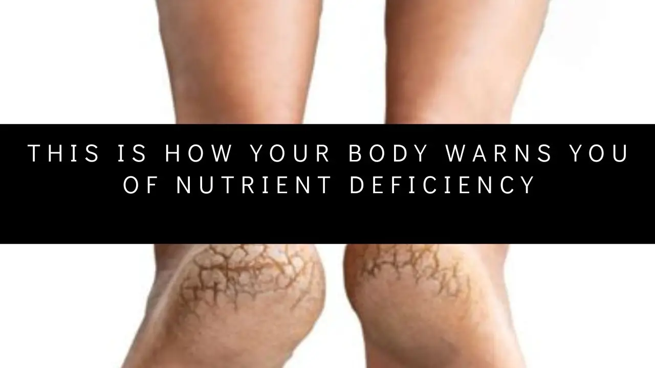 This is how your body WARNS you of nutrient deficiency